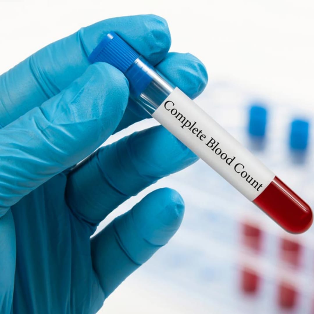 COMPLETE HEMOGRAM TEST