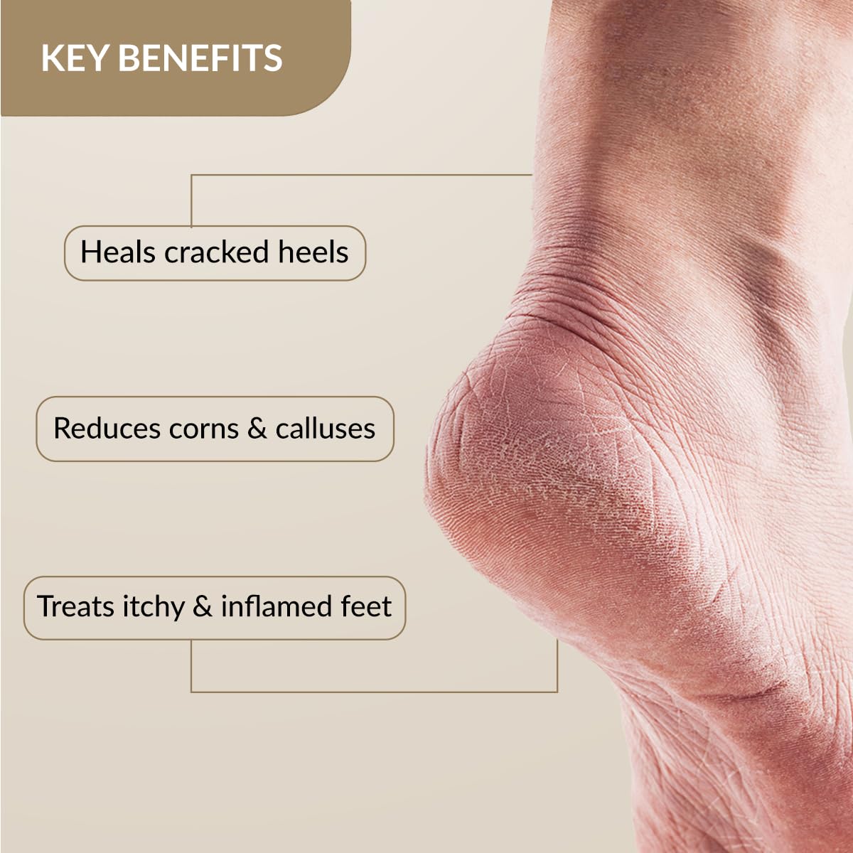 FIXDERMA FOOBETIK CREAM, FOOT CREAM, FOOT CARE FOR DIABETIC, FOR DRY & CRACKED FEET 50GM