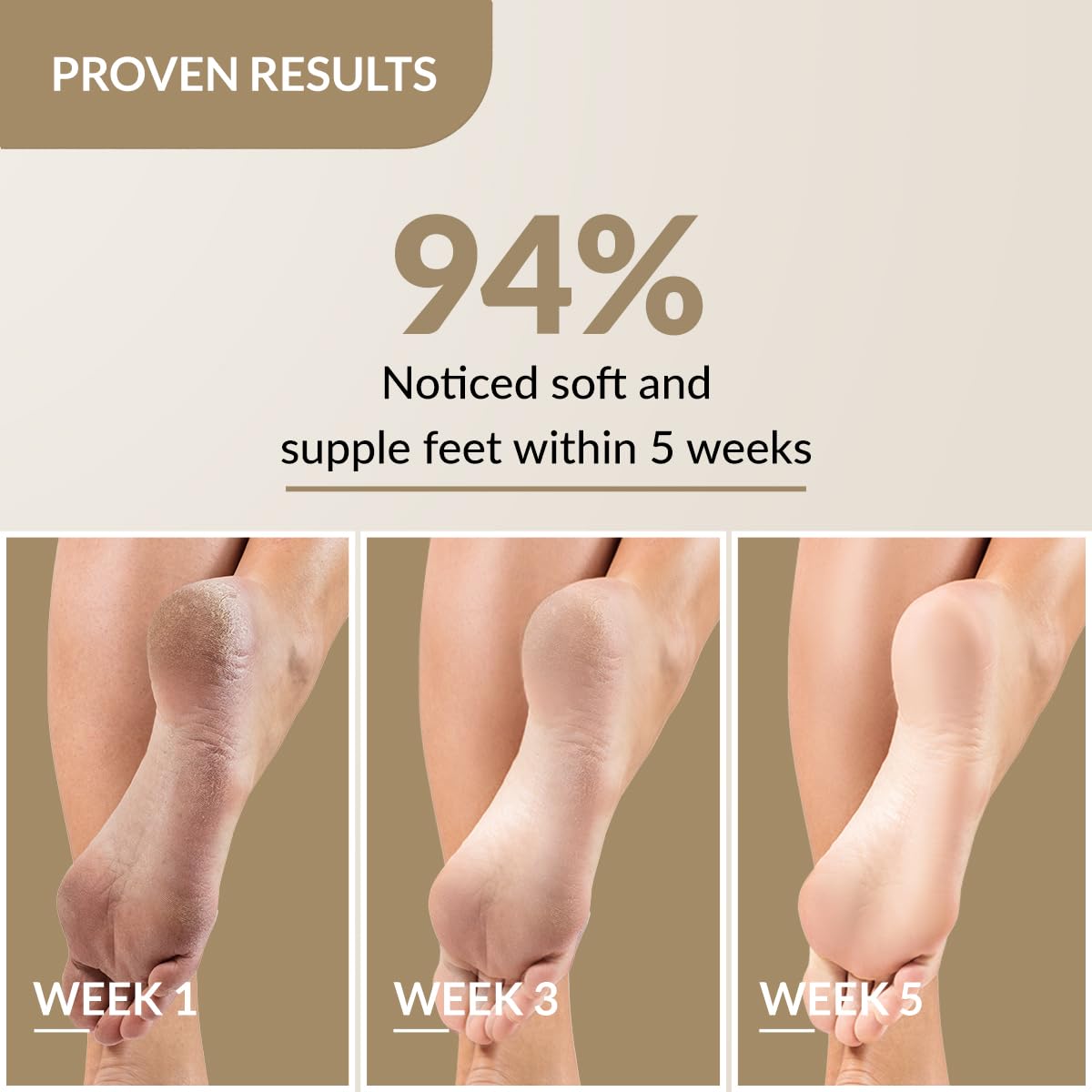FIXDERMA FOOBETIK CREAM, FOOT CREAM, FOOT CARE FOR DIABETIC, FOR DRY & CRACKED FEET 50GM