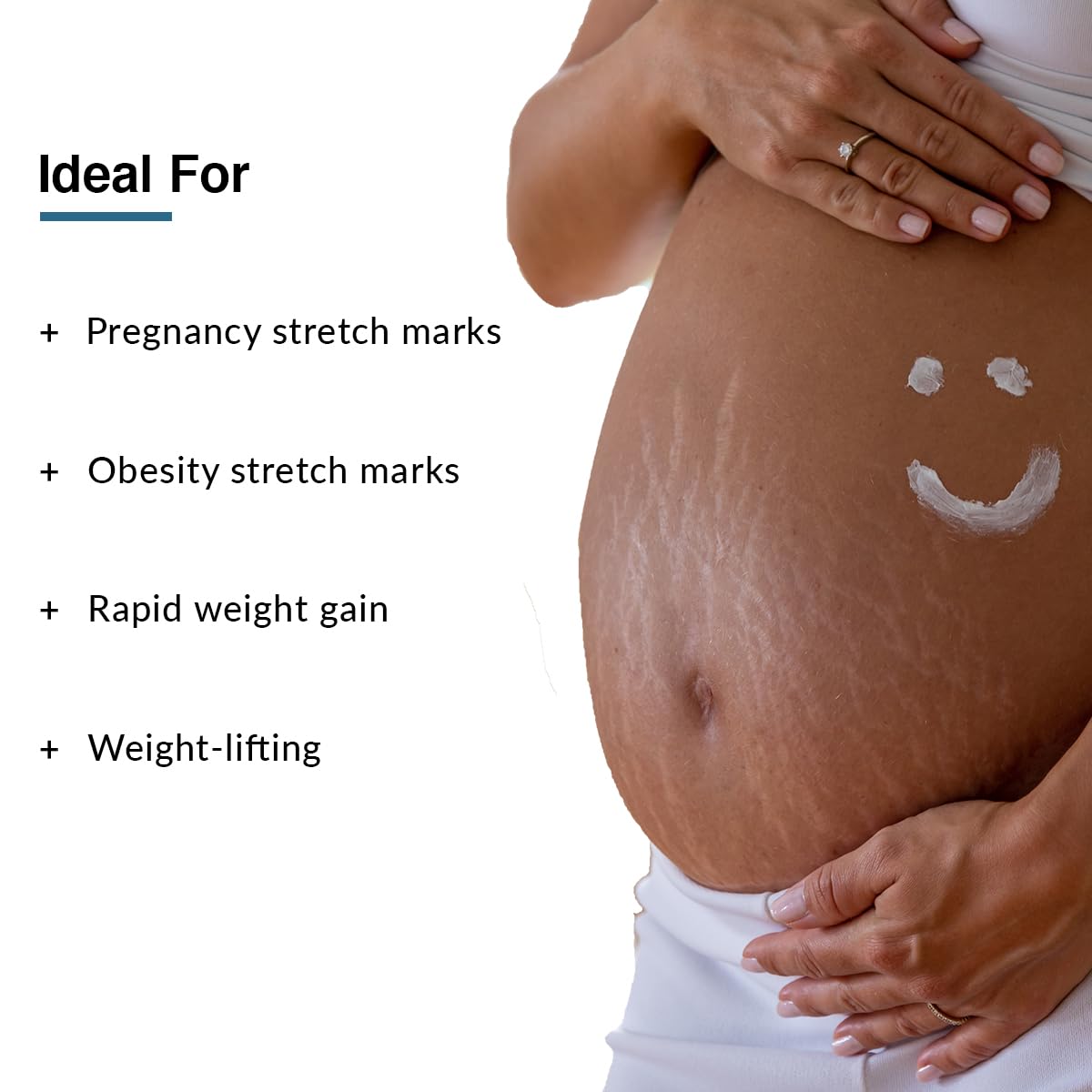 FIXDERMA STRALLIUM STRETCH MARK , REMOVES PREGNANCY STRETCH MARKS 75GM