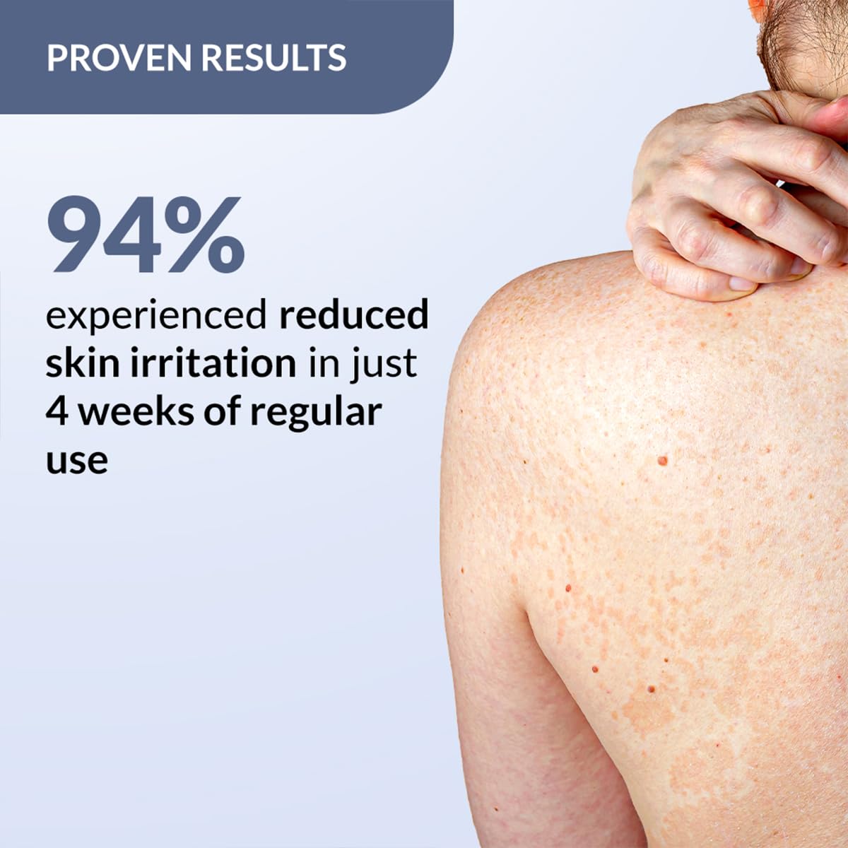 FIXDERMA 2% SALICYLIC ACID SALYZAP BODY SPRAY FOR ACNE ON BACK, SHOULDERS, NECK & CHEST 50ML