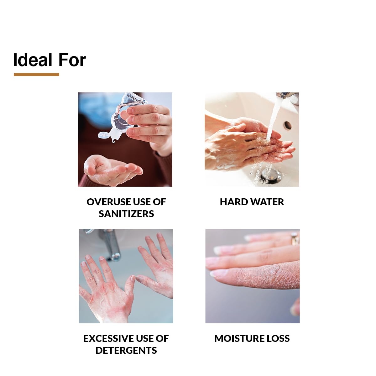 FIXDERMA HAND CREAM FOR WOMEN & MEN FOR DRY AND ROUGH HANDS 30GM