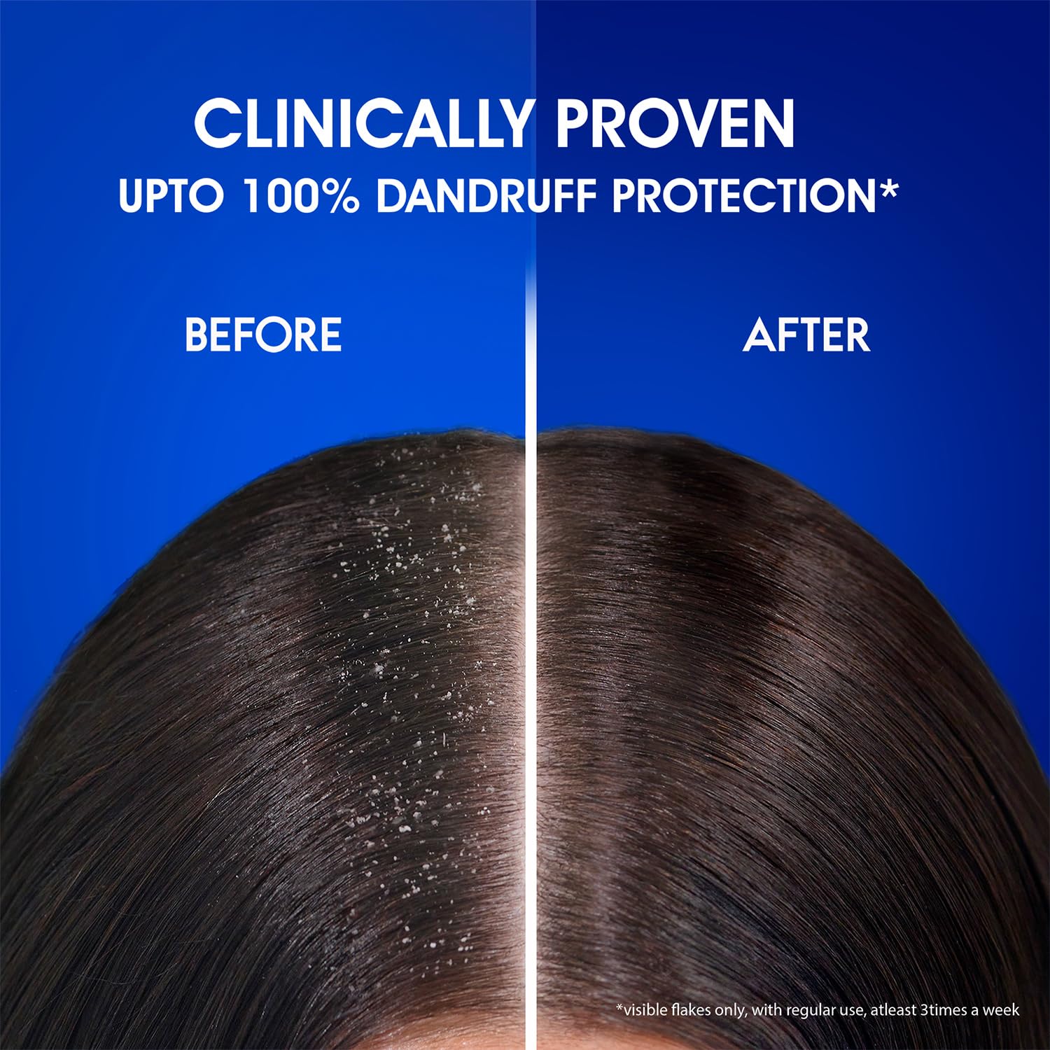 HEAD & SHOULDERS , ANTI DANDRUFF SHAMPOO, ANTI HAIRFALL, 340 ML