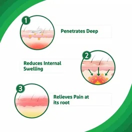 IODEX ULTRA GEL 30GM
